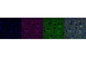 Immunohistochemistry (IHC) image for anti-Ubiquitin Carboxyl-terminal Esterase L1 (Ubiquitin Thiolesterase) (UCHL1) antibody (ABIN7455975) (UCHL1 抗体)