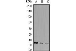 Western blot analysis of PPA1 expression in HepG2 (A), HT29 (B), mouse liver (C) whole cell lysates. (Pyrophosphatase (Inorganic) 1 (PPA1) 抗体)