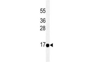THEM2 antibody western blot analysis in HeLa lysate. (THEM2 抗体)