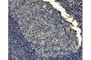 IHC analysis of Clathrin heavy chain/CLTC using anti-Clathrin heavy chain/CLTC antibody (ABIN7602703). (Clathrin Heavy Chain (CLTC) (AA 967-1668) 抗体)