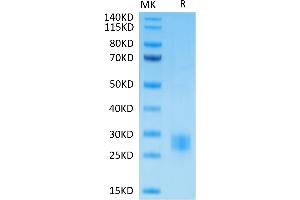 SDS-PAGE (SDS) image for Cytotoxic T-Lymphocyte-Associated Protein 4 (CTLA4) protein (His-Avi Tag,Biotin) (ABIN7274437)