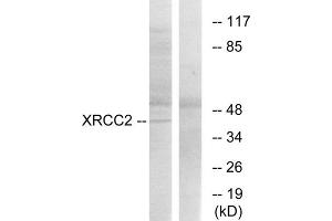 Western blot analysis of extracts from 293cells, using XRCC2 antibody. (XRCC2 抗体  (C-Term))