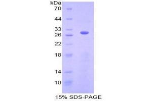 SDS-PAGE analysis of Human ACTC1 Protein. (ACTC1 蛋白)
