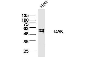 HeLa cell lysates probed with DAK Polyclonal Antibody, unconjugated (bs-20314R) at 1:300 overnight at 4°C followed by a conjugated secondary antibody for 60 minutes at 37°C. (DAK 抗体  (AA 101-200))