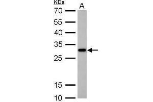 Western Blotting (WB) image for anti-CTD (Carboxy-terminal Domain, RNA Polymerase II, Polypeptide A) Small Phosphatase 2 (CTDSP2) (Center) antibody (ABIN2855986)
