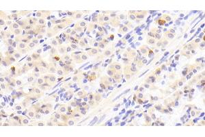 Detection of GT in Human Stomach Tissue using Polyclonal Antibody to Gastrin (GT) (Gastrin 抗体  (AA 1-101))
