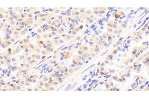 Detection of GT in Human Stomach Tissue using Polyclonal Antibody to Gastrin (GT)