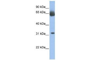 WB Suggested Anti-C11orf54 Antibody Titration:  0. (C11orf54 抗体  (N-Term))
