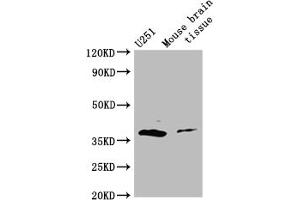 Western Blot Positive WB detected in: Mouse brain tissue All lanes: ADORA2B antibody at 3 μg/mL Secondary Goat polyclonal to rabbit IgG at 1/50000 dilution Predicted band size: 37 kDa Observed band size: 37 kDa (Adenosine A2b Receptor 抗体  (AA 292-332))