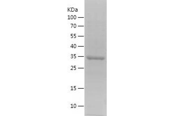 ELL Protein (AA 308-560) (His tag)