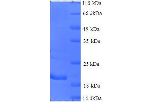 SDS-PAGE (SDS) image for Cancer/testis Antigen 1B (CTAG1B) (AA 1-180), (full length) protein (His tag) (ABIN5713382) (CTAG1B Protein (AA 1-180, full length) (His tag))