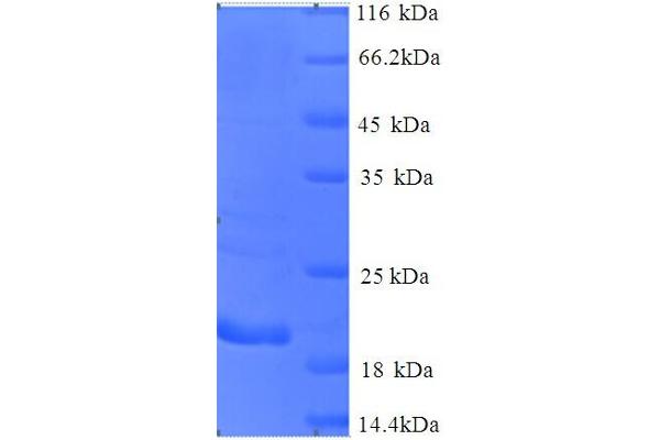 CTAG1B Protein (AA 1-180, full length) (His tag)