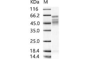 Respiratory Syncytial Virus Fusion Protein (RSV F) protein (His tag)