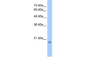 WB Suggested Anti-DNTTIP1 Antibody Titration:  2. (DNTTIP1 抗体  (N-Term))