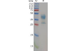 Malic Enzyme Complex, Mitochondrial (Mod2) (AA 72-113) protein (Fc Tag)