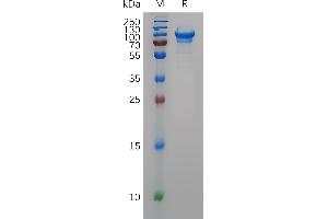 SDS-PAGE (SDS) image for CD93 (CD93) (AA 23-572) protein (His tag) (ABIN7490799)