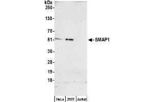 anti-Stromal Membrane Associated Protein 1 (SMAP1) (AA 417-467) antibody