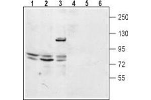 Western blot analysis of mouse kidney lysate (lanes 1 and 4), rat lung membrane (lanes 2 and 5) and human embryonic Kidney 293 cell lysate (lanes 3 and 6): - 1-3. (TPCN2 抗体  (2nd Lumenal Region))