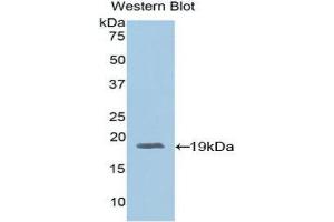 Western Blotting (WB) image for anti-Adrenomedullin (ADM) (AA 24-171) antibody (ABIN1857923) (Adrenomedullin 抗体  (AA 24-171))