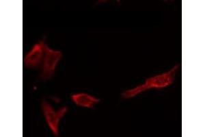 ABIN6266589 staining HepG2 by IF/ICC. (MMP1 抗体  (C-Term))