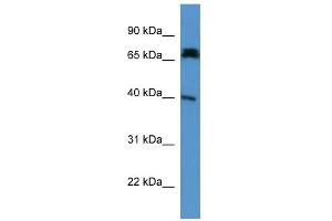 WB Suggested Anti-Dcdc2a Antibody Titration: 0. (DCDC2 抗体  (N-Term))