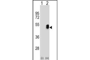Western blot analysis of LMX1B (arrow) using rabbit polyclonal LMX1B Antibody (Center) (ABIN652882 and ABIN2842570). (LMX1B 抗体  (AA 175-202))