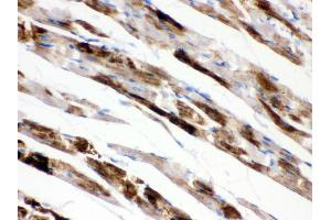 Anti- MAOA Picoband antibody,IHC(P) IHC(P): Rat Cardiac Muscle Tissue (Monoamine Oxidase A 抗体  (C-Term))