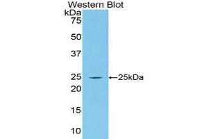 Western Blotting (WB) image for anti-Procollagen III N-Terminal Propeptide (PIIINP) (AA 34-272) antibody (Biotin) (ABIN1173224) (PIIINP 抗体  (AA 34-272) (Biotin))