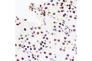 Immunohistochemical analysis of DCK staining in rat kidney formalin fixed paraffin embedded tissue section. (DCK 抗体)