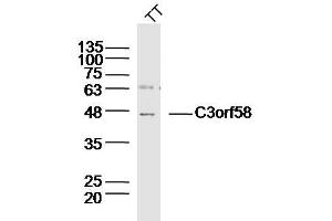 Human TT lysates probed with C3orf58 Polyclonal Antibody, Unconjugated  at 1:300 dilution and 4˚C overnight incubation. (C3orf58 抗体  (AA 351-430))