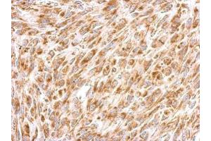 IHC-P Image Prohibitin 2 antibody detects PHB2 protein at cytosol on U87 xenograft by immunohistochemical analysis. (Prohibitin 2 抗体)