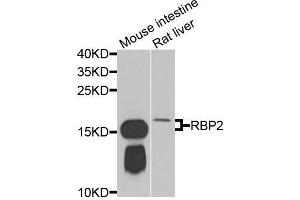 Western blot analysis of extracts of various cell lines, using RBP2 antibody (ABIN5974059) at 1/1000 dilution. (RBP2 抗体)