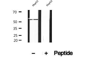 Western blot analysis of extracts of HepG2 cells, using SHMT1 antibody.