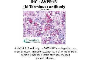 Image no. 1 for anti-Arginine Vasopressin Receptor 1B (AVPR1B) (Extracellular Domain), (N-Term) antibody (ABIN1732152) (AVPR1B 抗体  (Extracellular Domain, N-Term))