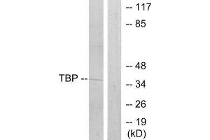 Western Blotting (WB) image for anti-TATA Box Binding Protein (TBP) (Internal Region) antibody (ABIN1849232) (TBP 抗体  (Internal Region))