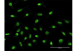 Immunofluorescence of monoclonal antibody to RPS2 on HeLa cell. (RPS2 抗体  (AA 47-170))