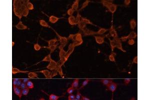 Immunofluorescence analysis of NIH/3T3 cells using ABCB11 Polyclonal Antibody at dilution of 1:100. (ABCB11 抗体)