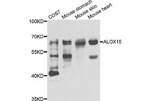 Western blot analysis of extracts of various cell lines, using ALOX15 antibody. (ALOX15 抗体)
