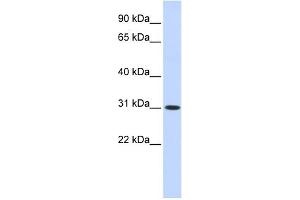 WB Suggested Anti-CYB5D2 Antibody Titration: 0. (CYB5D2 抗体  (N-Term))