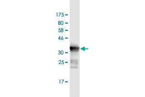 Western Blot detection against Immunogen (36. (DDX41 抗体  (AA 523-622))