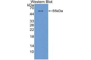Western blot analysis of the recombinant protein. (CPT1A 抗体  (AA 572-773))