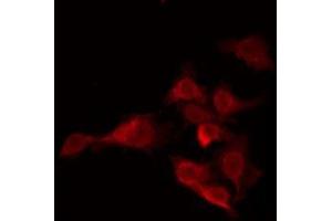 ABIN6276098 staining COLO205 by IF/ICC. (OR5H15 抗体  (C-Term))
