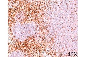IHC testing of human tonsil stained with CD6 antibody (3F7B5). (CD6 抗体)