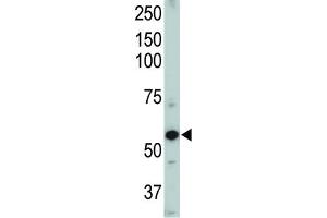 Western Blotting (WB) image for anti-Activin A Receptor Type II-Like 1 (ACVRL1) antibody (ABIN3003504)