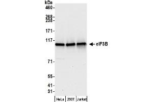 Western Blotting (WB) image for anti-Eukaryotic Translation Initiation Factor 3, Subunit B (EIF3B) (AA 100-150) antibody (ABIN7453629)