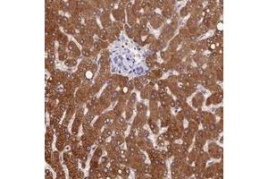 Immunohistochemical staining of human liver with PPP4R4 polyclonal antibody  shows strong cytoplasmic positivity in hepatocytes at 1:200-1:500 dilution. (PPP4R4 抗体)