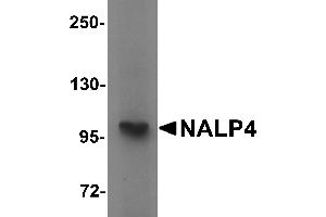 Western blot analysis of NALP4 in K562 cell lysate with NALP4 antibody at 1 µg/mL. (NLRP4 抗体  (Middle Region))