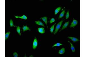 Immunofluorescent analysis of Hela cells using ABIN7157273 at dilution of 1:100 and Alexa Fluor 488-congugated AffiniPure Goat Anti-Rabbit IgG(H+L) (KLHL2 抗体  (AA 1-155))