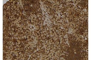 anti-General Transcription Factor IIA, 1, 19/37kDa (GTF2A1) (Internal Region) antibody