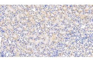 Detection of MCP1 in Mouse Kidney Tissue using Polyclonal Antibody to Monocyte Chemotactic Protein 1 (MCP1) (CCL2 抗体  (AA 24-96))